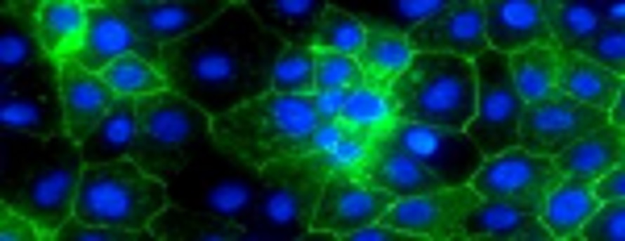 liver cells