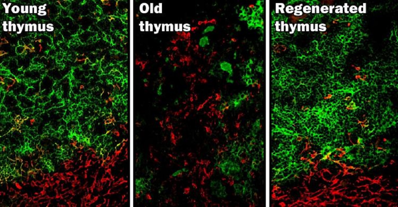 Thymus graphic
