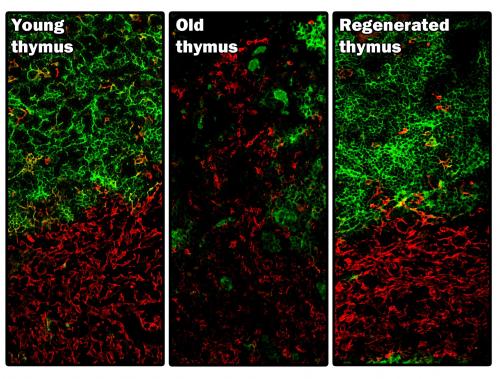 Young, old and regenerated thymus