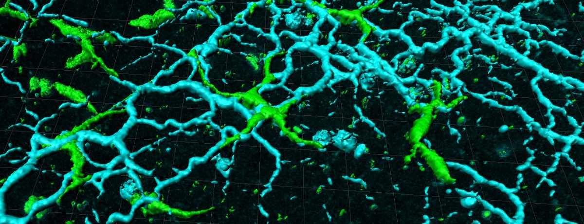 In vivo image of liver macrophages (green) with liver collagen matrix (blue)