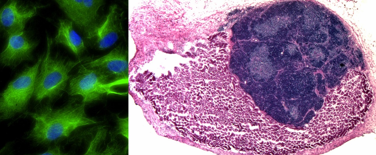 Fibroblasts transformed into induced thymic epithelial cells in vitro, iTEC transplanted onto the mouse kidney form mini-thymus